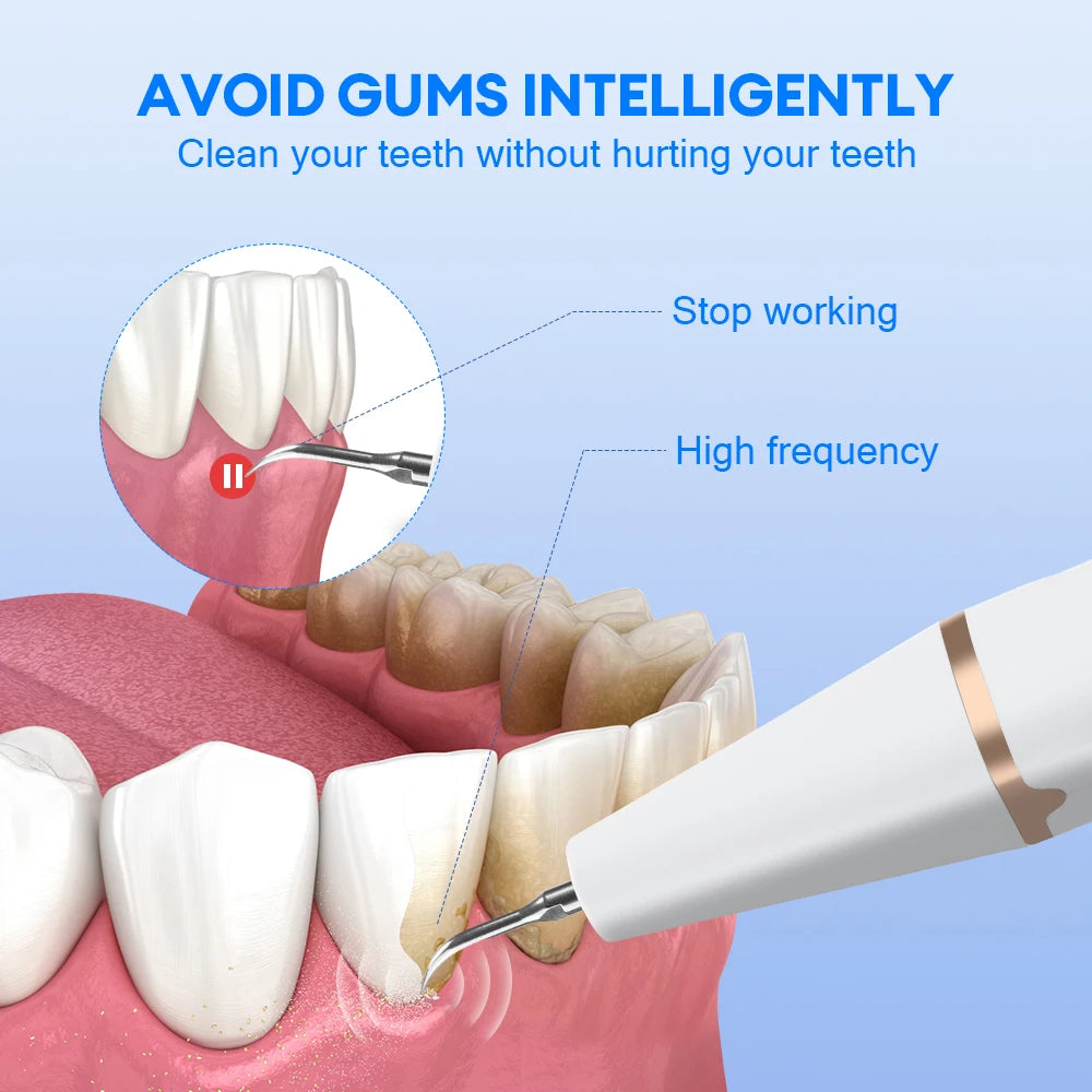 Plaque and tartar remover