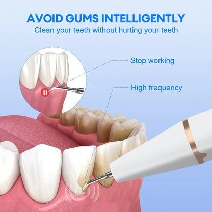 Plaque and tartar remover